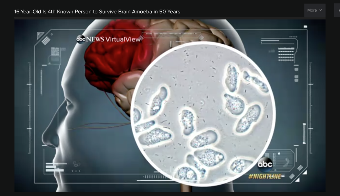ABC News - Sebastian DeLeon Survives Brain Eating Amoeba - Naegleria fowleri Amoeba
